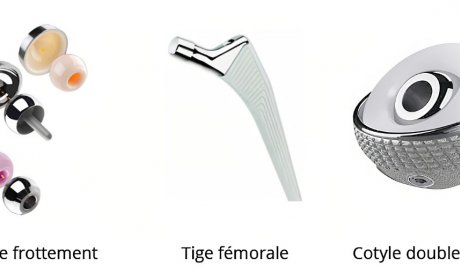 Distributeur de dispositifs médicaux en orthopédie et en traumatologie, Saint-Paul, ERGONE medical services