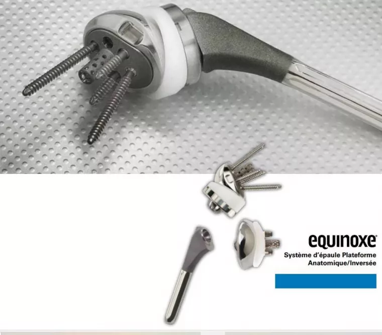 Prothèse d'épaule anatomique / Prothèse inversée de première intention et traumatologique : EXACTECH à la Réunion, Saint-Paul, ERGONE medical services