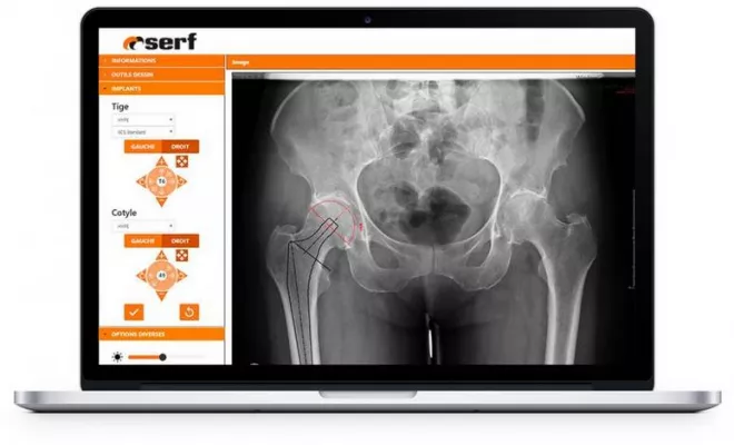 Distributeur de dispositifs médicaux en orthopédie et en traumatologie, Saint-Paul, ERGONE medical services