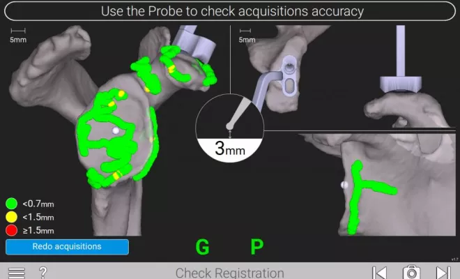 Distributeur de dispositifs médicaux en orthopédie et en traumatologie, Saint-Paul, ERGONE medical services